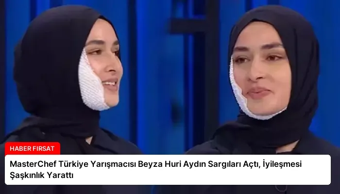MasterChef Türkiye Yarışmacısı Beyza Huri Aydın Sargıları Açtı, İyileşmesi Şaşkınlık Yarattı
